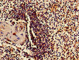 RPS15 / Ribosomal Protein S15 Antibody - Immunohistochemistry of paraffin-embedded human spleen tissue using RPS15 Antibody at dilution of 1:100