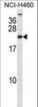 RPS16 / Ribosomal Protein S16 Antibody - RPS16 Antibody western blot of NCI-H460 cell line lysates (35 ug/lane). The RPS16 antibody detected the RPS16 protein (arrow).