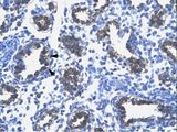 RPS16 / Ribosomal Protein S16 Antibody - RPS16 antibody ARP33535_T100-NP_001011-RPS16 (ribosomal protein S16) Antibody was used in IHC to stain formalin-fixed, paraffin-embedded human lung.  This image was taken for the unconjugated form of this product. Other forms have not been tested.