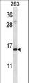 RPS19 / Ribosomal Protein S19 Antibody - RPS19 Antibody western blot of 293 cell line lysates (35 ug/lane). The RPS19 antibody detected the RPS19 protein (arrow).