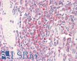 RPS19 / Ribosomal Protein S19 Antibody - Human Tonsil: Formalin-Fixed, Paraffin-Embedded (FFPE)