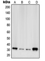 RPS2 / Ribosomal Protein S2 Antibody - Western blot analysis of RPS2 expression in A431 (A); HeLa (B); HEK293 (C); NIH3T3 (D) whole cell lysates.