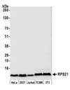 RPS21 / Ribosomal Protein S21 Antibody - Detection of human and mouse RPS21 by western blot. Samples: Whole cell lysate (50 µg) from HeLa, HEK293T, Jurkat, mouse TCMK-1, and mouse NIH 3T3 cells prepared using NETN lysis buffer. Antibody: Affinity purified rabbit anti-RPS21 antibody used for WB at 0.04 µg/ml. Detection: Chemiluminescence with an exposure time of 10 seconds.