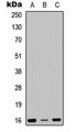 RPS23 / Ribosomal Protein S23 Antibody - Western blot analysis of RPS23 expression in SHSY5Y (A); HEK293T (B); NIH3T3 (C) whole cell lysates.