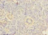 RPS24 / Ribosomal Protein S24 Antibody - Immunohistochemistry of paraffin-embedded human pancreatic tissue using antibody at dilution of 1:100.