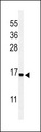 RPS25 / Ribosomal Protein S25 Antibody - Western blot of RPS25 Antibody in Jurkat cell line lysates (35 ug/lane). RPS25 (arrow) was detected using the purified antibody.