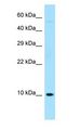 RPS27 / Ribosomal Protein S27 Antibody - RPS27 / MPS1 antibody Western Blot of Fetal Liver.  This image was taken for the unconjugated form of this product. Other forms have not been tested.