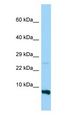 RPS28 / Ribosomal Protein S28 Antibody - RPS28 antibody Western Blot of MDA-MB-435S.  This image was taken for the unconjugated form of this product. Other forms have not been tested.