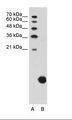 RPS29 / Ribosomal Protein S29 Antibody - A: Marker, B: Jurkat Cell Lysate.  This image was taken for the unconjugated form of this product. Other forms have not been tested.
