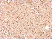 RPS3A / Ribosomal Protein S3A Antibody - RPS3A antibody detects RPS3A protein at cytosol and nucleus on U87 xenograft by immunohistochemical analysis. Sample: Paraffin-embedded U87 xenograft. RPS3A antibody dilution:1:500.