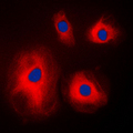 RPS4X Antibody - Immunofluorescent analysis of RPS4X staining in A431 cells. Formalin-fixed cells were permeabilized with 0.1% Triton X-100 in TBS for 5-10 minutes and blocked with 3% BSA-PBS for 30 minutes at room temperature. Cells were probed with the primary antibody in 3% BSA-PBS and incubated overnight at 4 C in a humidified chamber. Cells were washed with PBST and incubated with a DyLight 594-conjugated secondary antibody (red) in PBS at room temperature in the dark. DAPI was used to stain the cell nuclei (blue).