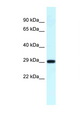 Antibody - RPS4Y1 antibody Western blot of Fetal Lung lysate. Antibody concentration 1 ug/ml.  This image was taken for the unconjugated form of this product. Other forms have not been tested.