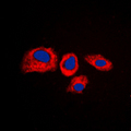 RPS4Y1 Antibody - Immunofluorescent analysis of RPS4Y1 staining in K562 cells. Formalin-fixed cells were permeabilized with 0.1% Triton X-100 in TBS for 5-10 minutes and blocked with 3% BSA-PBS for 30 minutes at room temperature. Cells were probed with the primary antibody in 3% BSA-PBS and incubated overnight at 4 C in a humidified chamber. Cells were washed with PBST and incubated with a DyLight 594-conjugated secondary antibody (red) in PBS at room temperature in the dark. DAPI was used to stain the cell nuclei (blue).