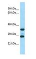RPS6 / Ribosomal Protein S6 Antibody - RPS6 / S6 antibody Western Blot of Rat Muscle.  This image was taken for the unconjugated form of this product. Other forms have not been tested.