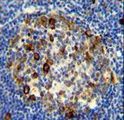 RPS6 / Ribosomal Protein S6 Antibody - RPS6 antibody (Ser240/244) immunohistochemistry of formalin-fixed and paraffin-embedded human tonsil tissue followed by peroxidase-conjugated secondary antibody and DAB staining.