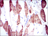 RPS6KB1 / P70S6K / S6K Antibody - IHC of paraffin-embedded muscle tissues using RPS6KB1 mouse monoclonal antibody with DAB staining.