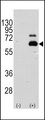 RPS6KB1 / P70S6K / S6K Antibody - Western blot of RPS6KB1 (arrow) using rabbit polyclonal RPS6KB1 Antibody (S404) (RB11396). 293 cell lysates (2 ug/lane) either nontransfected (Lane 1) or transiently transfected with the RPS6KB1 gene (Lane 2) (Origene Technologies).