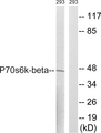 RPS6KB2 / S6K2 Antibody - Western blot analysis of lysates from 293 cells, using p70 S6 Kinase beta Antibody. The lane on the right is blocked with the synthesized peptide.