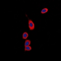RPS6KC1 Antibody - Immunofluorescent analysis of RPS6KC1 staining in HeLa cells. Formalin-fixed cells were permeabilized with 0.1% Triton X-100 in TBS for 5-10 minutes and blocked with 3% BSA-PBS for 30 minutes at room temperature. Cells were probed with the primary antibody in 3% BSA-PBS and incubated overnight at 4 deg C in a humidified chamber. Cells were washed with PBST and incubated with a DyLight 594-conjugated secondary antibody (red) in PBS at room temperature in the dark. DAPI was used to stain the cell nuclei (blue).