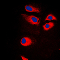 RPS9 /  Ribosomal Protein S9 Antibody - Immunofluorescent analysis of RPS9 staining in Jurkat cells. Formalin-fixed cells were permeabilized with 0.1% Triton X-100 in TBS for 5-10 minutes and blocked with 3% BSA-PBS for 30 minutes at room temperature. Cells were probed with the primary antibody in 3% BSA-PBS and incubated overnight at 4 C in a humidified chamber. Cells were washed with PBST and incubated with a DyLight 594-conjugated secondary antibody (red) in PBS at room temperature in the dark. DAPI was used to stain the cell nuclei (blue).