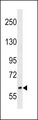 RREB1 Antibody - RREB1 Antibody western blot of NCI-H460 cell line lysates (35 ug/lane). The RREB1 antibody detected the RREB1 protein (arrow).