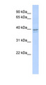 RRM2 Antibody - RRM2 antibody Western blot of Fetal Muscle lysate. This image was taken for the unconjugated form of this product. Other forms have not been tested.