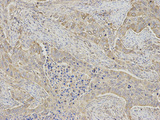 RRM2 Antibody - Immunohistochemistry of paraffin-embedded human stomach using RRM2 antibody at dilution of 1:200 (200x lens).