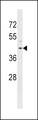 RRM2B / P53R2 Antibody - RRM2B Antibody western blot of HepG2 cell line lysates (35 ug/lane). The RRM2B antibody detected the RRM2B protein (arrow).