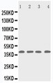 RRM2B / P53R2 Antibody - WB of RRM2B antibody. Lane 1: Rat Thymus Tissue Lysate. Lane 2: MCF-7 Cell Lysate. Lane 3: A431 Cell Lysate. Lane 4: HELA Cell Lysate..