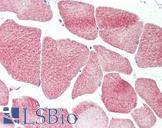RRP8 Antibody - Human Skeletal Muscle: Formalin-Fixed, Paraffin-Embedded (FFPE).  This image was taken for the unconjugated form of this product. Other forms have not been tested.