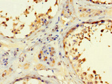 RSPH9 / C6orf206 Antibody - Paraffin-embedding Immunohistochemistry using human testis tissue at dilution 1:100