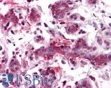 RSPO1 / RSPO Antibody - Anti-RSPO1 antibody IHC of human breast. Immunohistochemistry of formalin-fixed, paraffin-embedded tissue after heat-induced antigen retrieval. Antibody concentration 5 ug/ml.