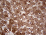 RSPO3 Antibody - IHC of paraffin-embedded Human liver tissue using anti-RSPO3 mouse monoclonal antibody. (heat-induced epitope retrieval by 1 mM EDTA in 10mM Tris, pH8.5, 120°C for 3min).