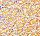 RSPO3 Antibody - Immunohistochemistry of paraffin-embedded human small intestine tissue using RSPO3 Antibody at dilution of 1:100