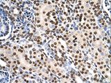 RSU1 Antibody - RSU1 antibody RSU1(Ras suppressor protein 1) Antibody was used in IHC to stain formalin-fixed, paraffin-embedded human kidney.  This image was taken for the unconjugated form of this product. Other forms have not been tested.