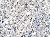 RTN2 / Reticulon 2 Antibody - RTN2 / Reticulon 2 antibody RTN2(reticulon 2) Antibody was used in IHC to stain formalin-fixed, paraffin-embedded human liver.  This image was taken for the unconjugated form of this product. Other forms have not been tested.
