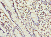 RUFY1 Antibody - Immunohistochemistry of paraffin-embedded human small intestine tissue at dilution 1:100