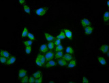 RUFY3 / RIPX Antibody - Immunofluorescence staining of Hela cells diluted at 1:133, counter-stained with DAPI. The cells were fixed in 4% formaldehyde, permeabilized using 0.2% Triton X-100 and blocked in 10% normal Goat Serum. The cells were then incubated with the antibody overnight at 4°C.The Secondary antibody was Alexa Fluor 488-congugated AffiniPure Goat Anti-Rabbit IgG (H+L).