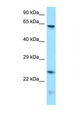 RUNX1T1 / ETO Antibody - RUNX1T1 antibody Western blot of Mouse Brain lysate. Antibody concentration 1 ug/ml.  This image was taken for the unconjugated form of this product. Other forms have not been tested.