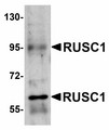 RUSC1 Antibody - Western blot of RUSC1 in A-20 cell lysate with RUSC1 antibody at 1 ug/ml.
