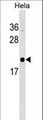 RWDD1 Antibody - RWDD1 Antibody western blot of HeLa cell line lysates (35 ug/lane). The RWDD1 antibody detected the RWDD1 protein (arrow).