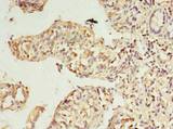 RWDD2A Antibody - Immunohistochemistry of paraffin-embedded human small intestine tissue using antibody at dilution of 1:100.