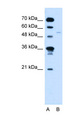 RXRG Antibody - RXRG antibody ARP38881_T100-NP_008848-RXRG(retinoid X receptor, gamma) Antibody Western blot of Jurkat lysate.  This image was taken for the unconjugated form of this product. Other forms have not been tested.