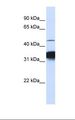 RXTA / RXR-Alpha Antibody - Jurkat cell lysate. Antibody concentration: 1.0 ug/ml. Gel concentration: 12%.  This image was taken for the unconjugated form of this product. Other forms have not been tested.