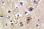 RYR2 / Ryanodine Receptor 2 Antibody - IHC of RyR2 (N2802) pAb in paraffin-embedded human brain tissue.