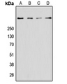 RYR2 / Ryanodine Receptor 2 Antibody - Western blot analysis of Ryanodine Receptor 2 expression in PC3 (A); MCF7 (B); NIH3T3 (C); mouse brain (D) whole cell lysates.