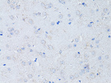 RYR2 / Ryanodine Receptor 2 Antibody - Immunohistochemistry of paraffin-embedded mouse brain using RYR2 Antibodyat dilution of 1:100 (40x lens).