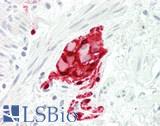 S100 Protein Antibody - Human Colon, Submucosal Plexus: Formalin-Fixed, Paraffin-Embedded (FFPE)