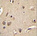 S100A1 / S100-A1 Antibody - S100A1 Antibody immunohistochemistry of formalin-fixed and paraffin-embedded human brain tissue followed by peroxidase-conjugated secondary antibody and DAB staining.