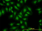S100A13 Antibody - Immunofluorescence of monoclonal antibody to S100A13 on HeLa cell. [antibody concentration 10 ug/ml]